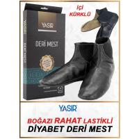 Mest Deri Diyabet